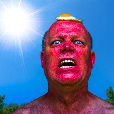 Photo of crazy sunburned man
